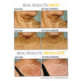 StriVectin 30mL TL Advanced Tightening Neck Cream Plus